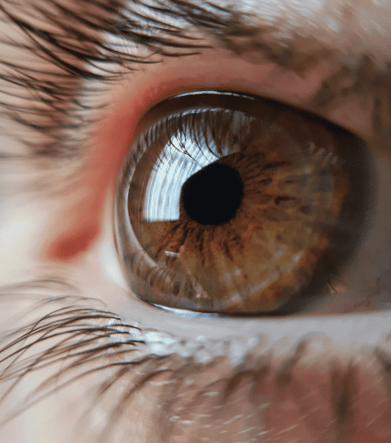 emdr
